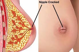 صور حلمة الصدر اشكال لحلمة الاثداء عبارات