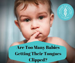 Are Too Many Babies Getting Their Tongues Clipped The Real Story Alabama Tongue Tie Center Dr Richard Baxter Birmingham Al