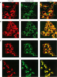 Check spelling or type a new query. Endoplasmic Reticulum And Golgi Apparatus Are The Preferential Sites Of Foscan Localisation In Cultured Tumour Cells British Journal Of Cancer