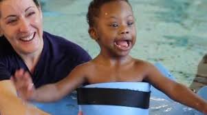 What is the difference between down syndrome and turner syndrome? Down Syndrome And Autistic Spectrum Disorder A Look At What We Know Kennedy Krieger Institute
