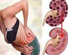 Remedio Caseiro Para Limpar Os Rins Naturaldetoxfacebook In 2020 Detox Kidney Detox Healthy Kidneys