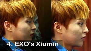 10 Idols Who Battled Acne K Pop Amino Acne Idol Skin