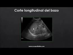 In his village they still use the name behind his back. 06 Bazo Youtube