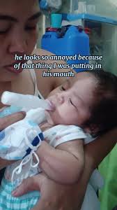 Baby Red Face After Using Nebulizer