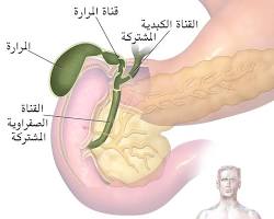 صورة المرارة (جهاز هضمي)