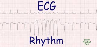 Search local ads for new & used cars 1.65.1 apk and all version for. Ecg Rhythm On Windows Pc Download Free 1 3 Com Xelomed Ecgrhythm
