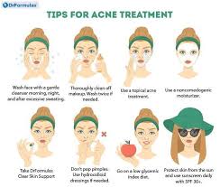 How To Get Rid Of Cystic Acne With 8 Home Remedies In 2020 Cystic Acne Acne Treatment Acne Treatment Overnight