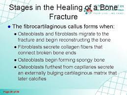 Fractures And Bone Healing Page 1 Of 39