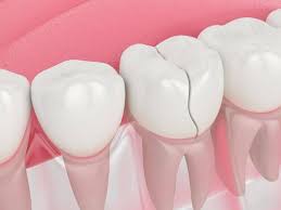 However, a new technique might help people to grow new. 5 Possible Reasons Your Child S Permanent Teeth Aren T Coming In All Star Dental