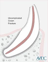 Avdc Nomenclature Avdc Org
