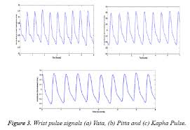 A Review Of Wrist Pulse Analysis