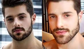 Bichectomia em homens é muito comum! Harmonizacao Facial Confira O Antes E Depois Dos Famosos