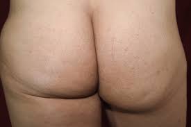 Nalga - Wikipedia, la enciclopedia libre