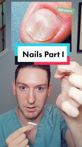 Image result for Onychotillomania feet