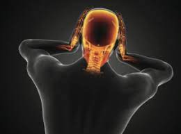Maybe you would like to learn more about one of these? Cervicogenic Headaches A Pain In The Neck Upstream