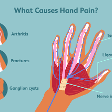 Check spelling or type a new query. Hand Pain Causes And Treatments