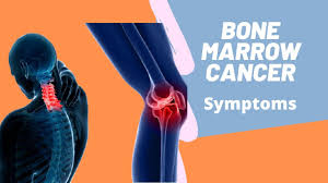 Was a bone marrow biopsy performed that shows less than the normal number of when: Bone Marrow Cancer Bone Marrow Disease Symptoms Youtube