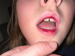 Hello! Can someone please tell me what is wrong with her lip/mouth area?  Thanks in advance 💕
