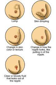 Our new guide, know the symptoms, provides a checklist of symptoms. Breast Cancer Wikipedia