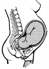 Image result for Paracervical Block