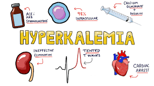 Image result for Hyperkalemia