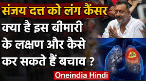 American cancer society internet atlanta, georgia, u.s; Sanjay Dutt Lung Cancer à¤œ à¤¨ à¤‡à¤¸à¤• Symptoms Prevention And Treatment à¤µà¤¨à¤‡ à¤¡ à¤¯ à¤¹ à¤¦ Youtube