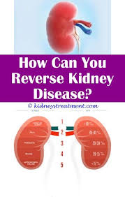 Awesome Useful Tips Kidney Disease Foods Eat Are There Different Types Of Kidney Disease First Polycystic Kidney Disease Kidney Disease Kidney Disease Stages