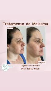 Catiane Soares da Silva