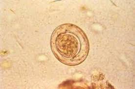 Pin On Hymenolepis Nana Dwarf Tapeworm
