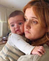 Publicidade nos stories, a cantora partilhou um vídeo a preto e branco e na descrição deu a conhecer: Depois Do Premio O Alerta Carolina Deslandes Revela Doenca De Santiago O Nosso Filho E Especial Nacional Flash