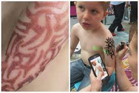 Husband just got his first tattoo done by matt a few days ago, and he was great! Boy Suffers Allergic Reaction From Black Henna Tattoo Wish Tv Indianapolis News Indiana Weather Indiana Traffic