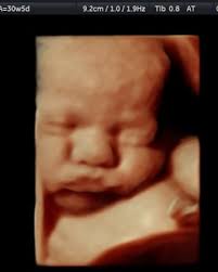 Tiny Blessings 3D...