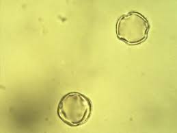 Image result for Burkea