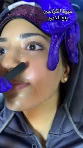 خيوط الكولاجين لشد الوجه: تجربتي وفوائدها