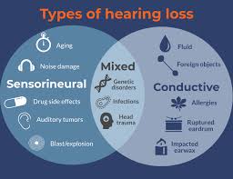 Hearing loss types - Learn about sensorineural, conductive and mixed