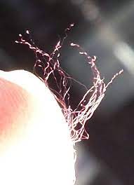 Morgellons disease information, support and research foundation helps people understand morgellons disease, it's symptoms and how to cope. February Is Morgellons Awareness Month