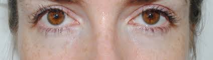 Being a product for dark eye circles fits one of my skin problems perfectly. Clinique Even Better Eye Dark Circle Corrector Review With Before And After Photos Really Ree