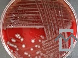 Image result for Shigella