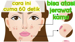 Tea tree oil tersedia di banyak cara menghilangkan bekas jerawat secara alami. Cuma 1 Menit Bisa Atasi Jerawat Kamu Youtube