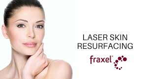 If you need botox injections, vaginal rejuvenation services or laser hair removal, turn to the center for laser & aesthetic medicine, llc. Fraxel Laser Skin Surfacing From Connecticut Skin Institute