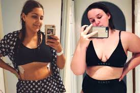Gallery - Plastic Surgery In Edmonton