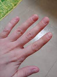 I Don't Want Long Nails, I Just Want Them To Look Clean : R/Calmhands