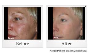 As of feb 2015, clarity medical spa has . Home San Jose Clarity Medical Spa In San Jose
