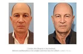 Center Aesthetic & Dermatology