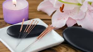 Image result for Acupuncture