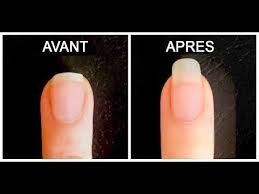 Faire Vite Pousser Ses Ongles Rapidement Et Les Fortifier Youtube Croissance Des Ongles Ongles Naturels Longs Ongles Naturels