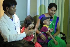 Image result for progeria case in bihar