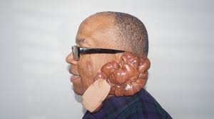 Fundraiser by Keith Crowell : Keith's Medical Fund