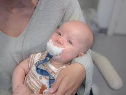 DN granskar: Föräldrar uppmuntras få barns tungband klippta