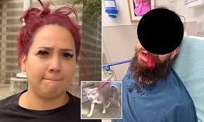 Pit bull owner arrested after dog ripped man's mouth off as he tried to  save his own pet from being attacked